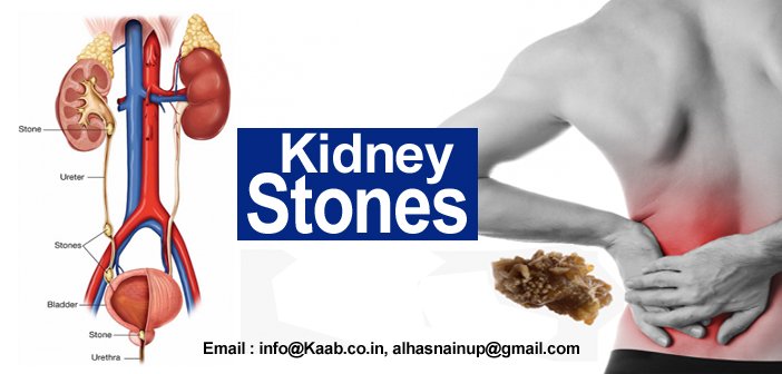 Herbal Treatment for Kidney Stone